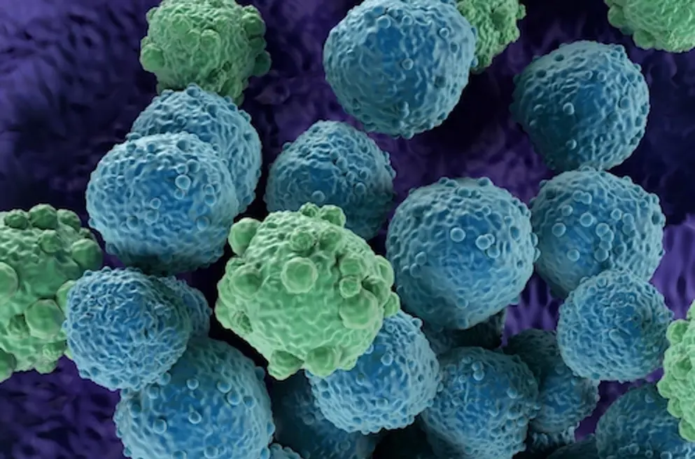 Digital image of green, blue, and purple lymphoma cells.