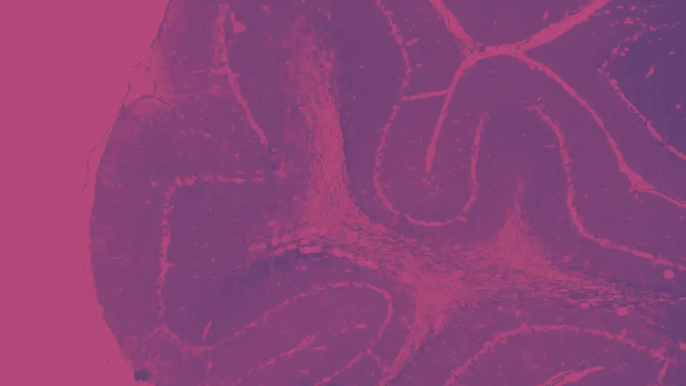 Thalamus, Medulla oblongata under microscope, pink and purple colours