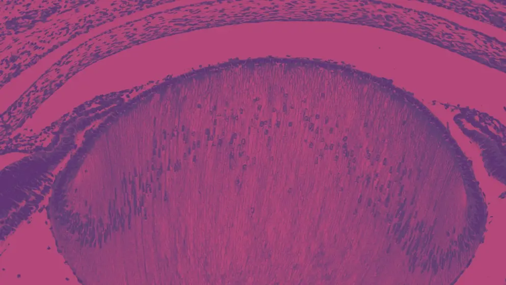 Lens fibers, cell image, pink and purple