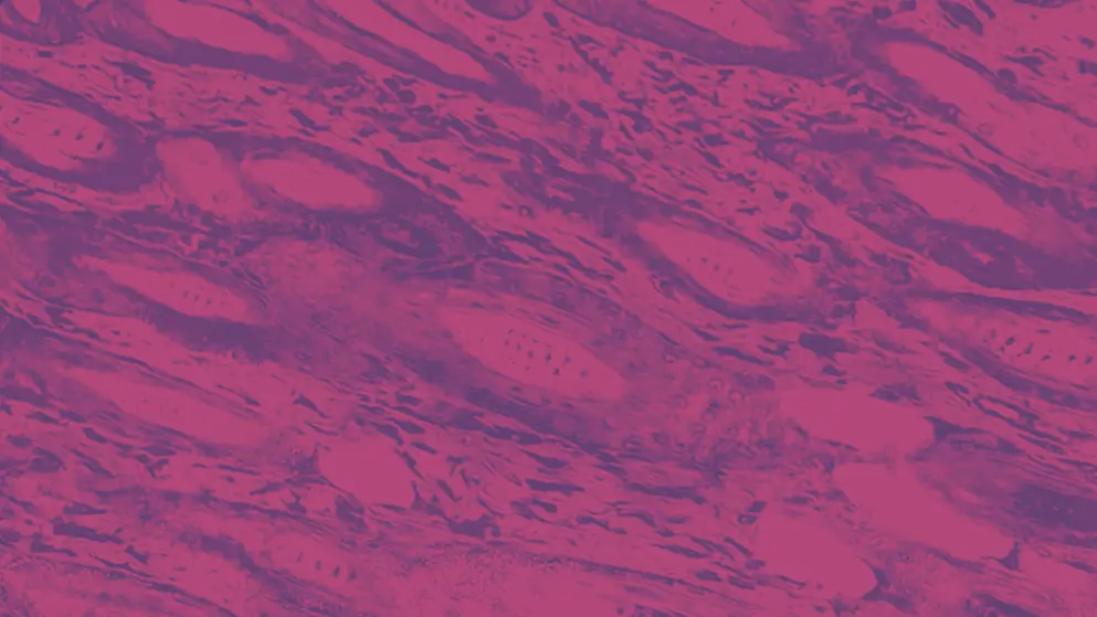 Cross section of Skin cells under microscope, pink and purple colours