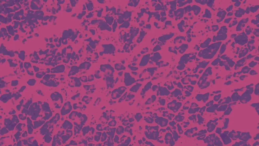 pancreas showing islets where insulin is produced, micrograph, pink and purple colours