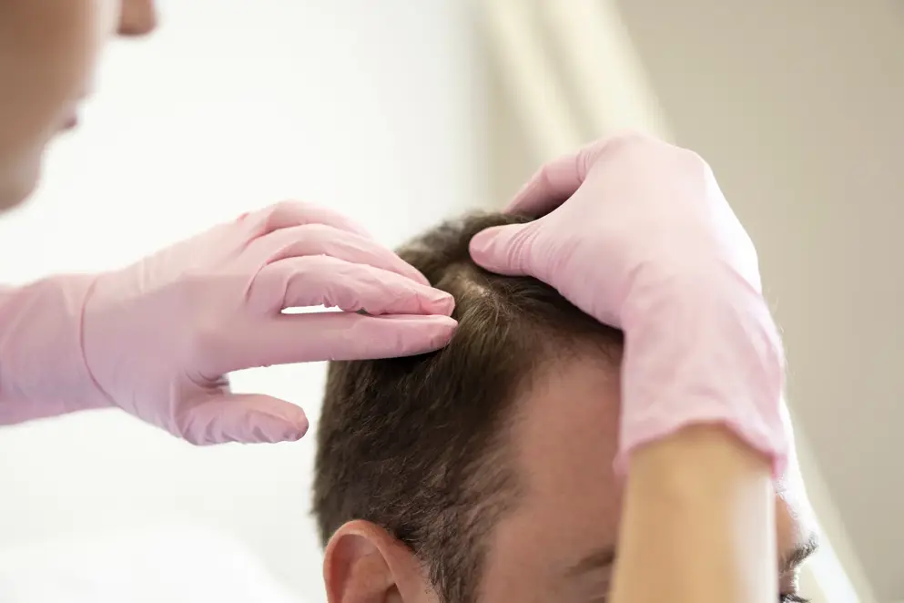 Checking the scalp, male patient, photo