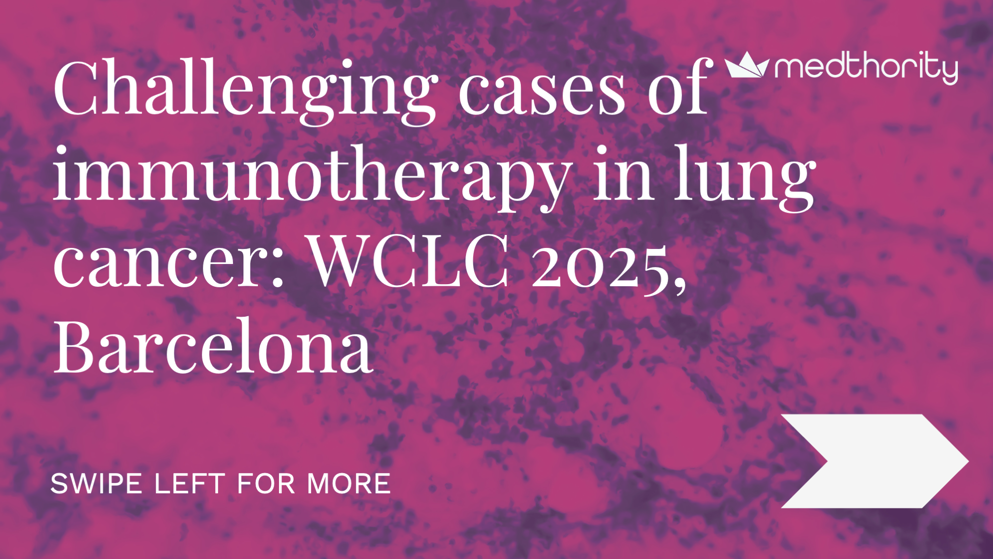 Title slide displaying the text: “Challenging cases of immunotherapy in lung cancer: WCLC 2025, Barcelona.” A swipe-left prompt indicates more slides are available.