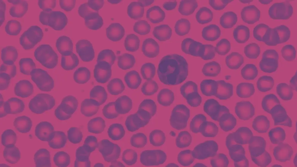  Blood sample showing basophil cell, cellular image, pink and purple colours
