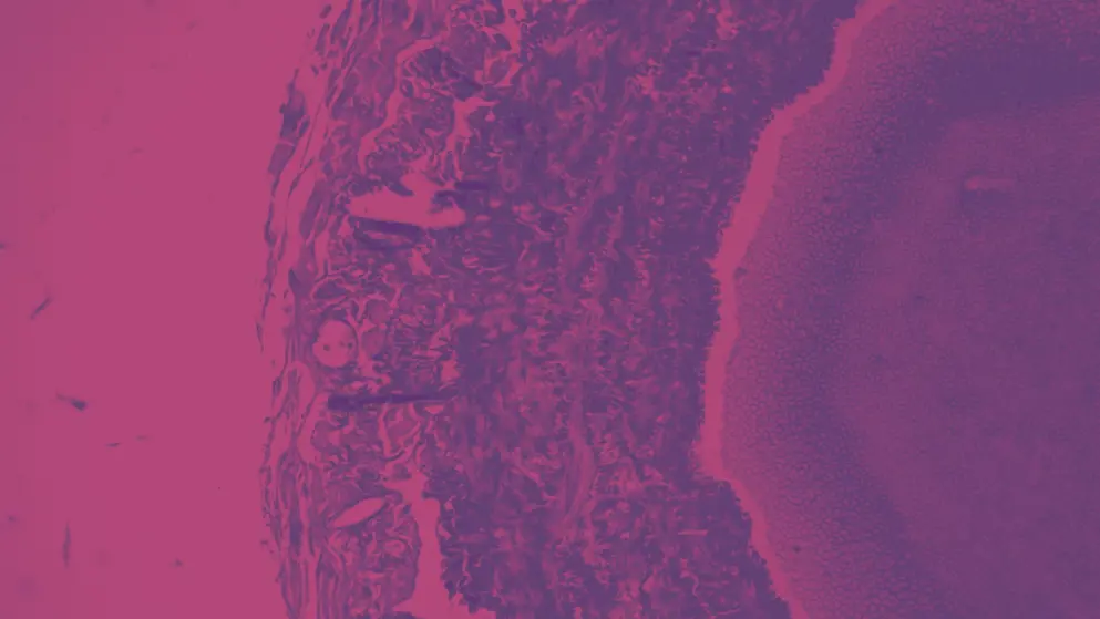 Artery and Heart muscle under the microscope, pink and purple colours