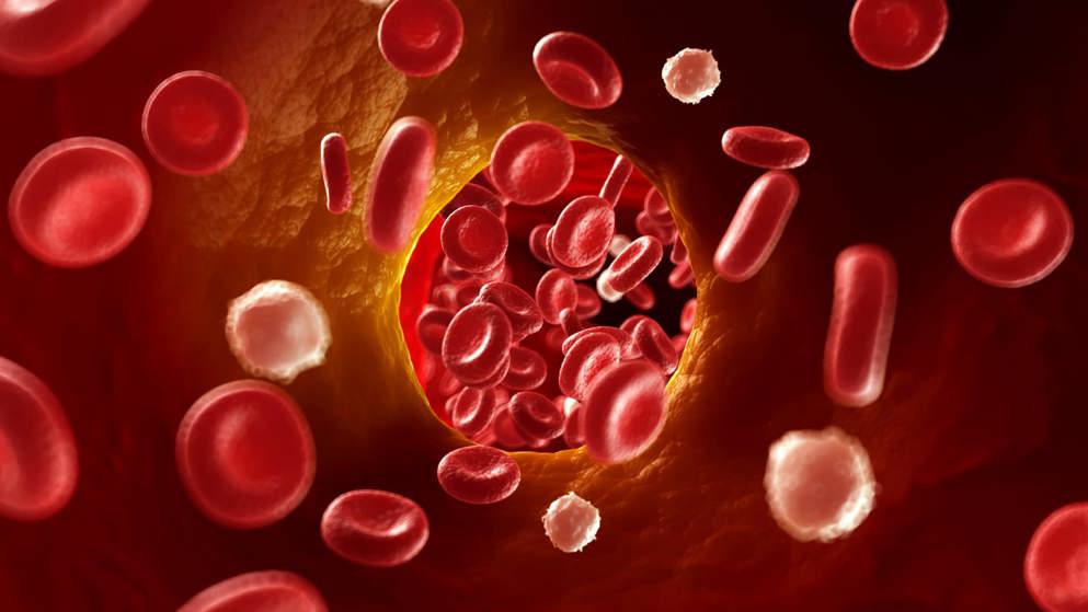 Lipid management in ASCVD