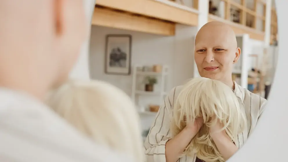 Alopecia areata learning zone