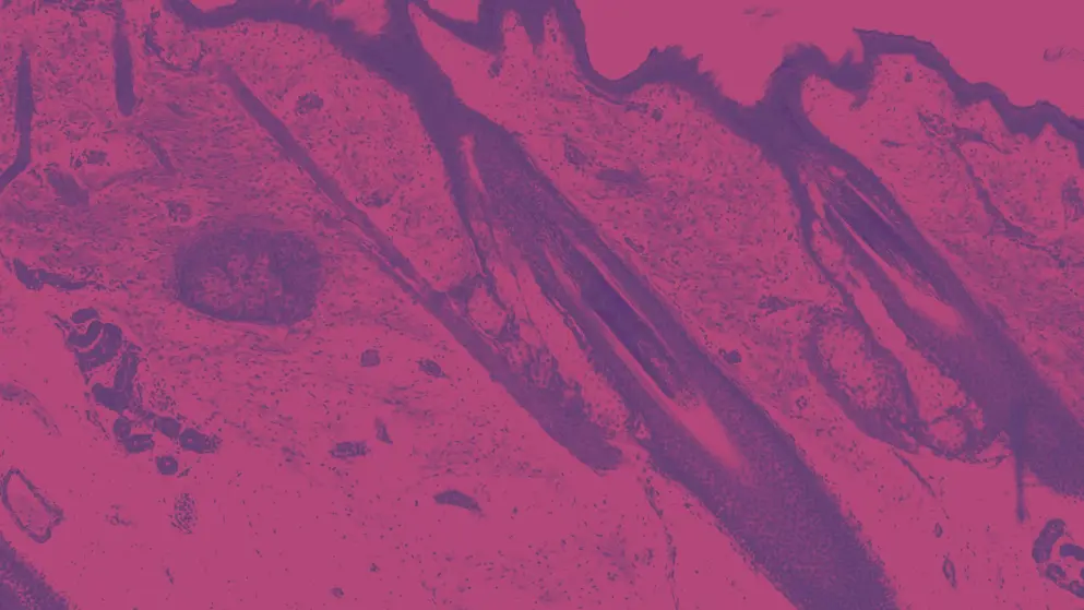 Hair follicles micrograph, pink and purple