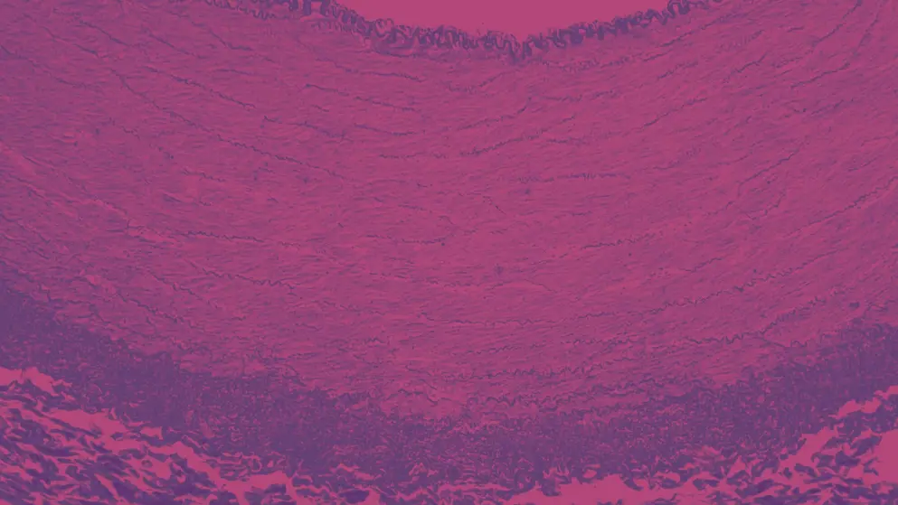 Artery, blood vessel, cellular image, pink and purple