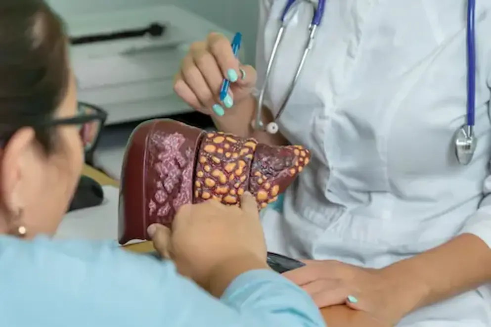 Anatomical model of a diseased human liver with nodules and irregular texture, held and examined by two people in a clinical setting. One person points to the liver with a pen while the other wears a stethoscope. 