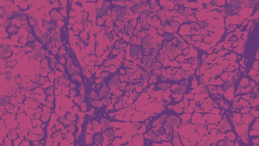 Cross-section of skeletal muscle. Photo under microscope. Pink and Purple colors