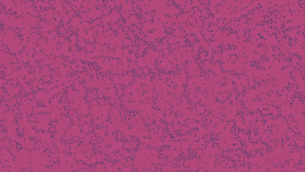 smear of red blood cells in blood plasma, pink overlay