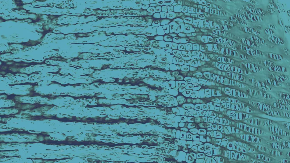 Developing bone Epiphyseal growth plate, blue overlay