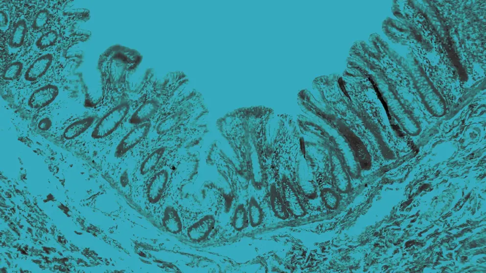 Human large intestine tissue, cellular image, blue overlay