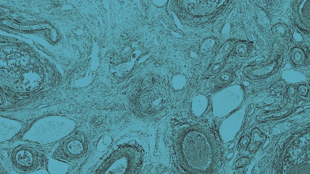 Ovary under the microscope, cell image, blue overlay