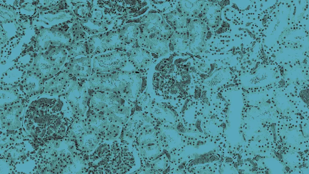 Renal congestion, cellular image, blue overlay