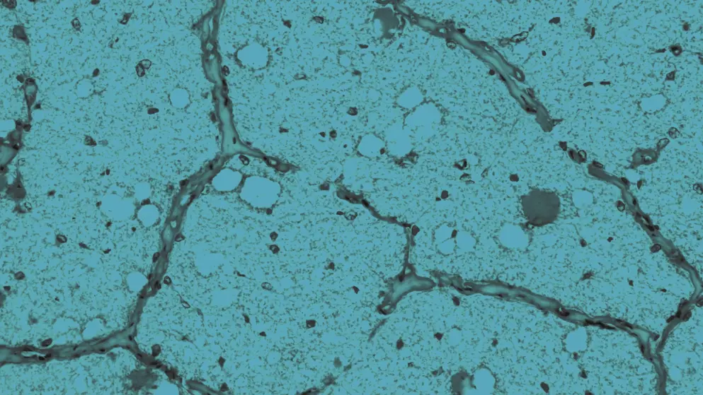 Cornea from eye, Optic nerve, cell image, blue overlay