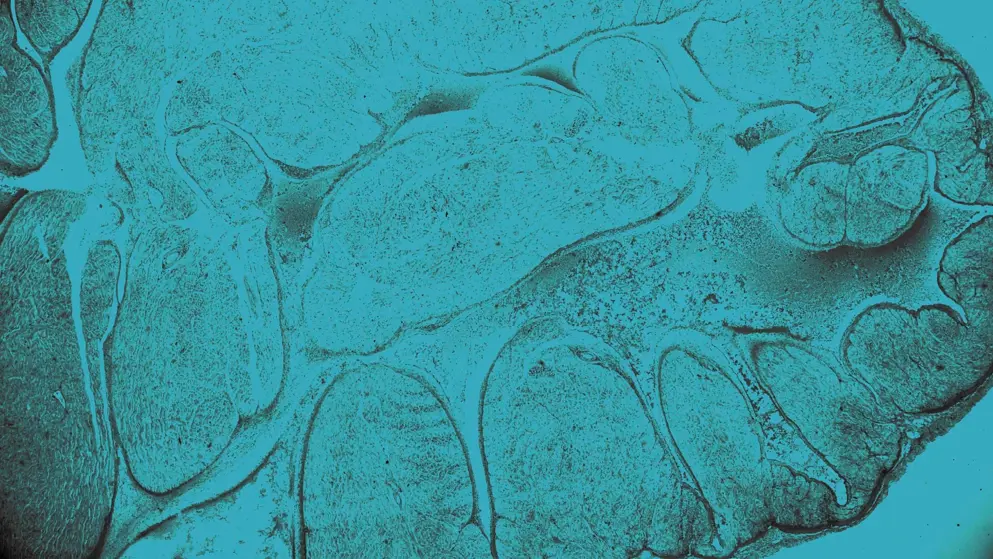 Cellular image, Heart muscle tissue, blue overlay