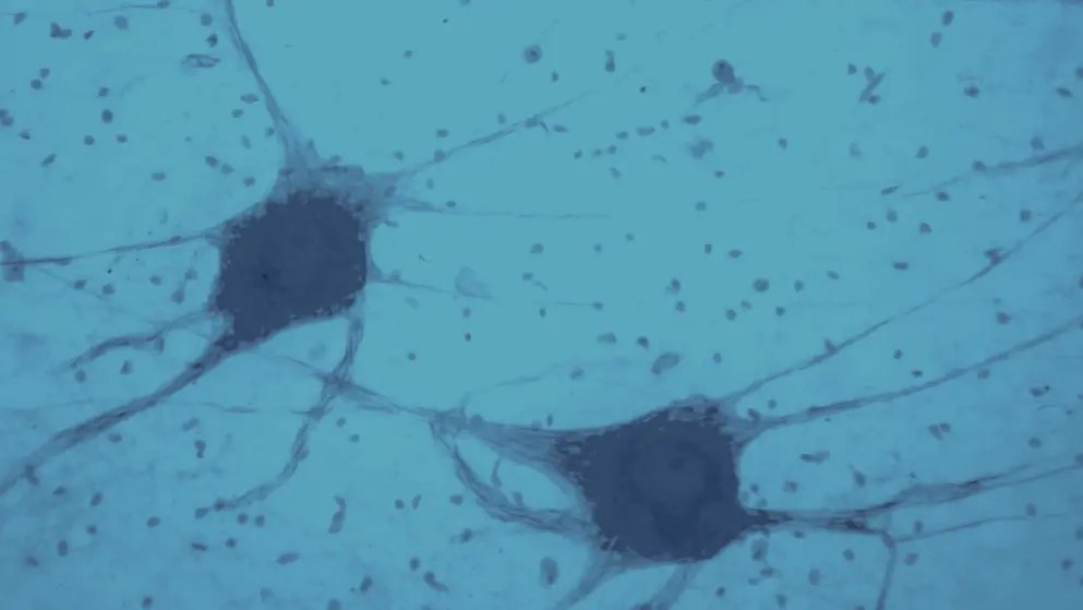 Histology of human brain tissue, Neurons, Glial Cells, blue overlay