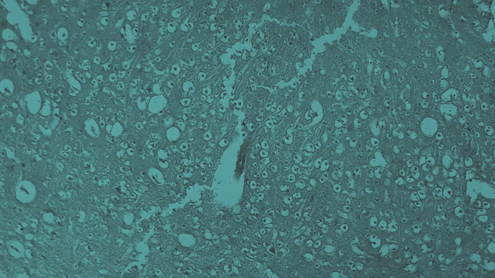 Human brain under the microscope, micrograph, blue overlay