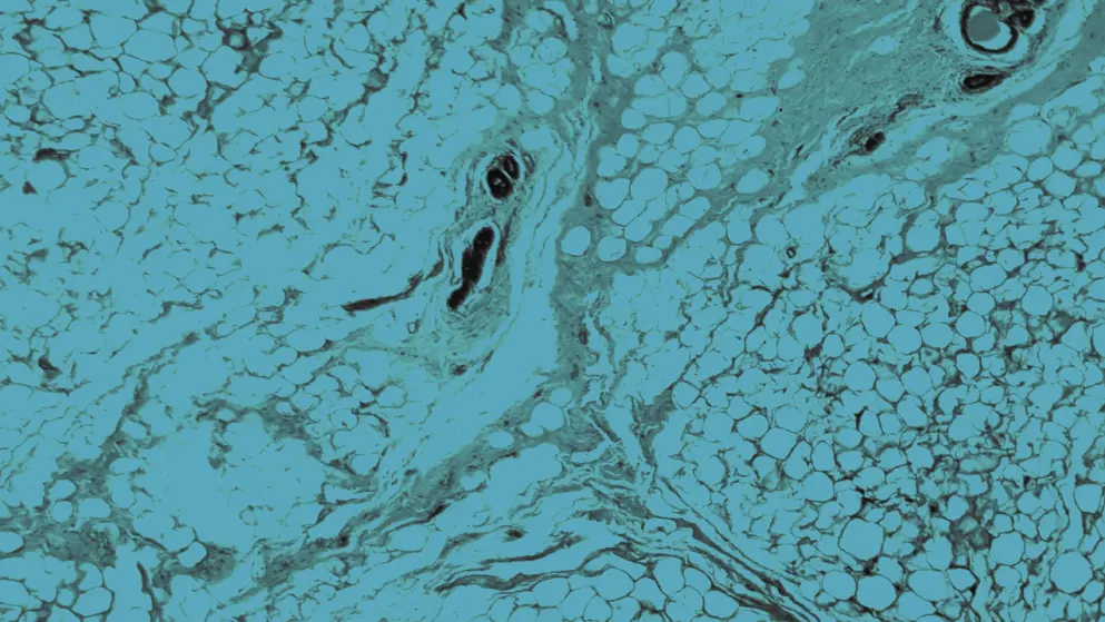 Human mammary gland, cell image, blue overlay