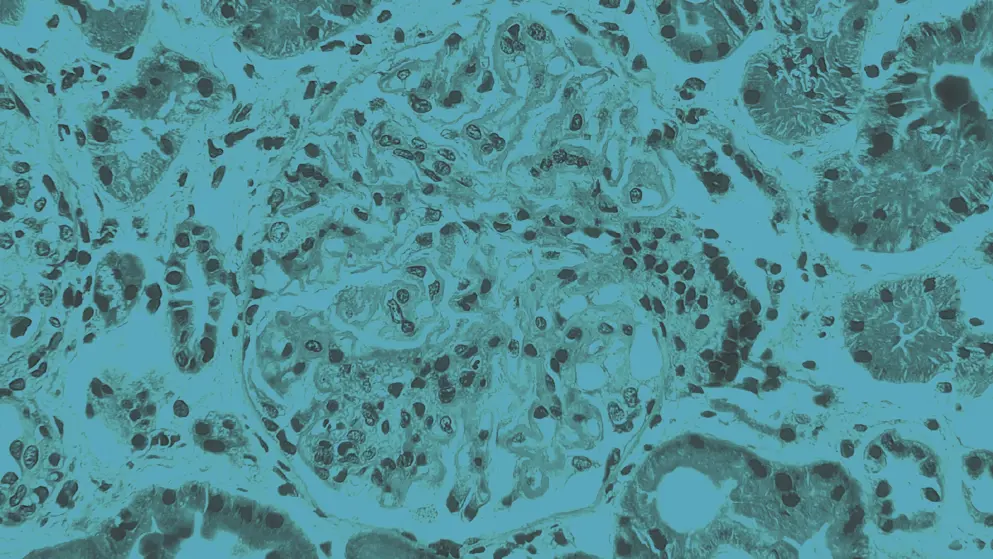 Kidney micrograph, blue overlay