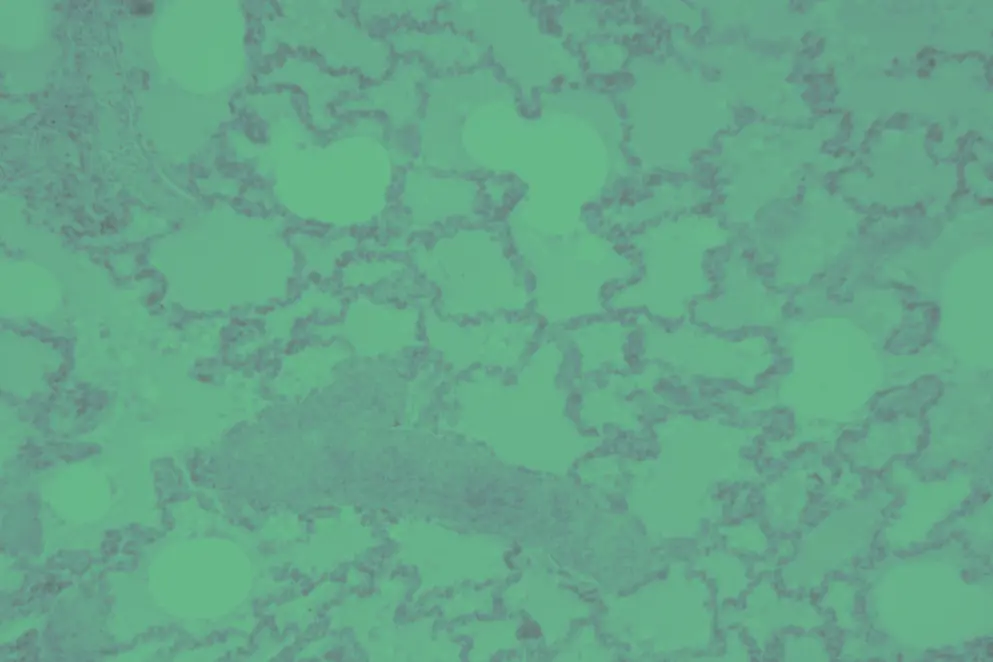 Lung tissue with pneumonia, cellular image, green overlay