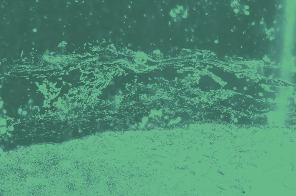Lymphatic node tissue, cellular image, green overlay