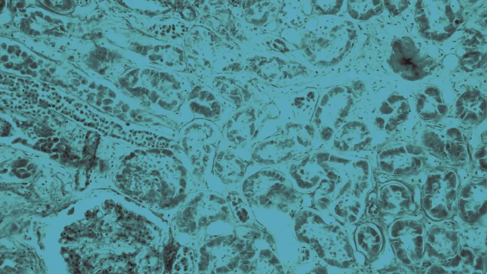 Kiddney micrograph, blue overlay