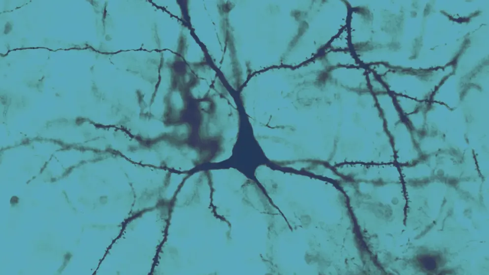 Pyramidal cell, cerebral cortex, cell image, blue overlay