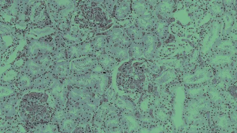 Renal congestion, cell image, green overlay
