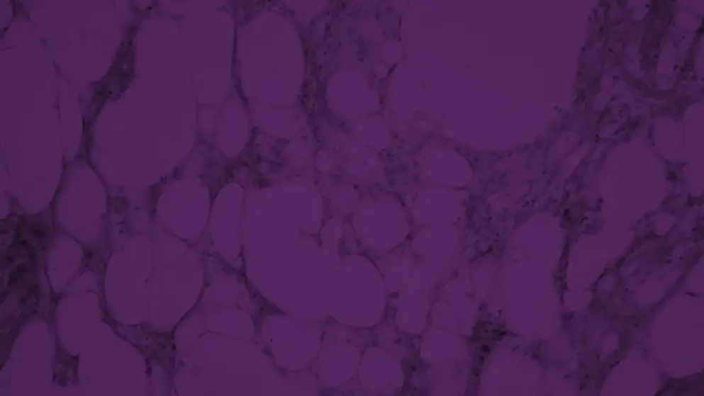 Micrograph of adrenal gland rendered in purples