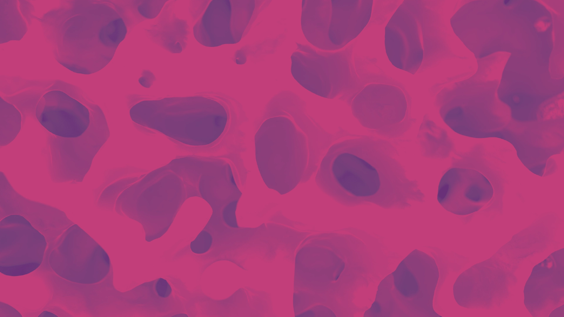 Micrograph of bone marrow rendered in pinks and purples