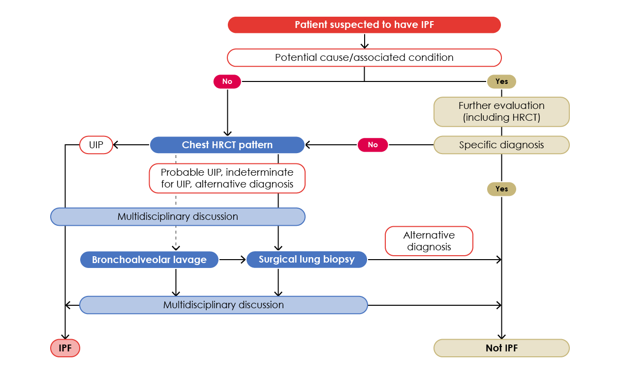 Diagnostic algorithm for IPF