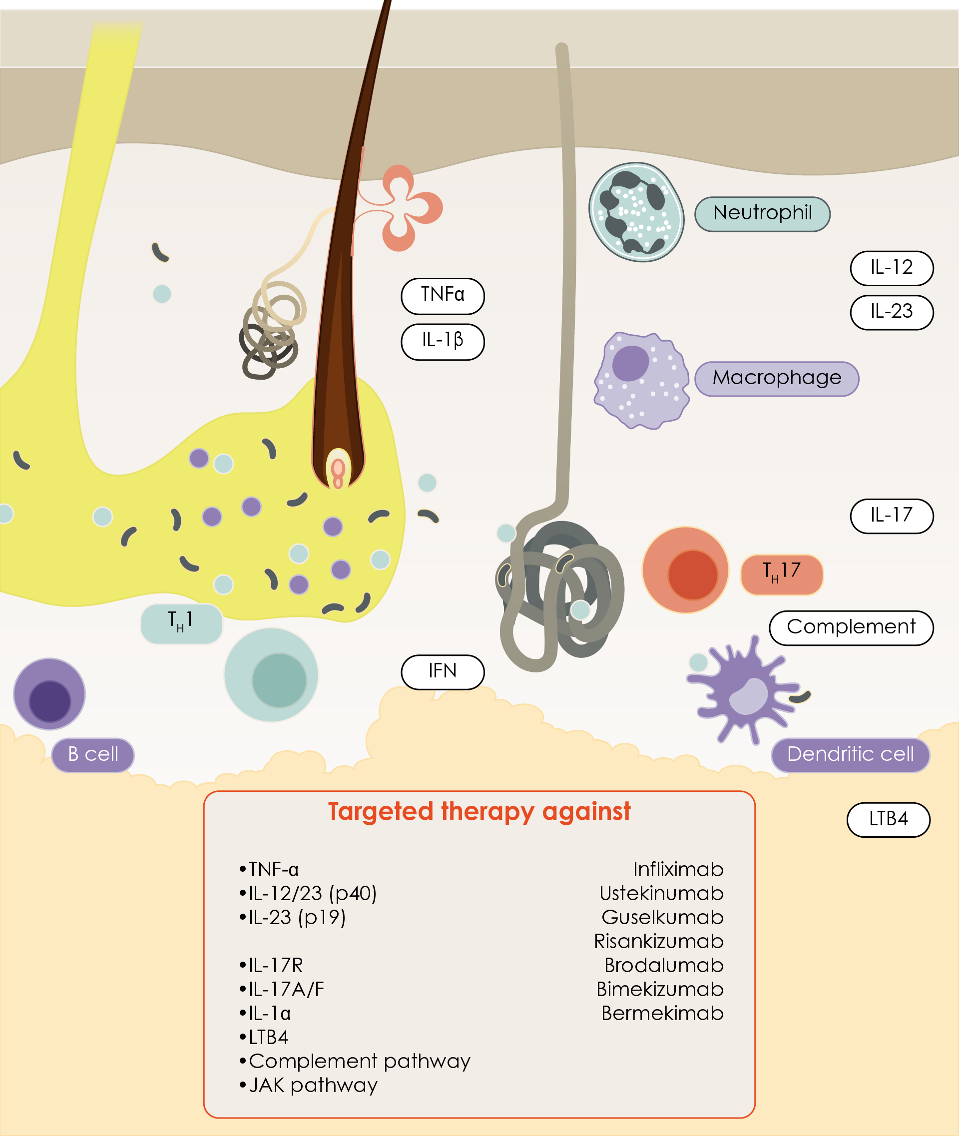 Figure 2. Proposed key cells and mediators in the evolution of hidradenitis suppurativa and associated pathogenesis-based target therapies under investigation (Adapted67). IL, interleukin; JAK, Janus kinase; LTB4, leukotriene B4; TNF-α, tumour necrosis factor alpha.