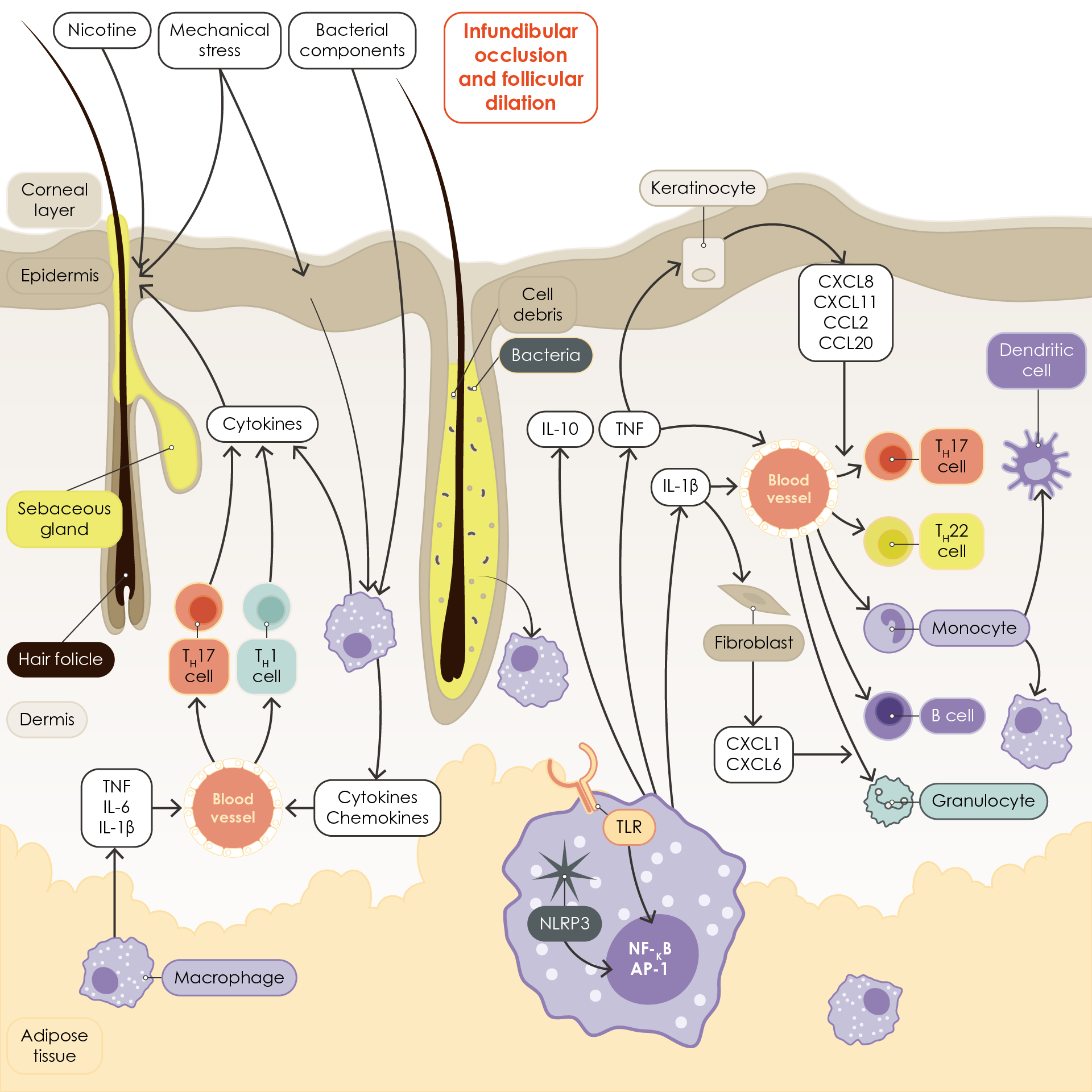 Diagram illustrating a cross-section of skin and the initial inflammatory pathways potentially involved in the pathogenesis of hidradenitis suppurativa. It also shows potential ‘triggers’ for these inflammatory processes (nicotine, mechanical stress, bacterial components) and the various types of cells involved.