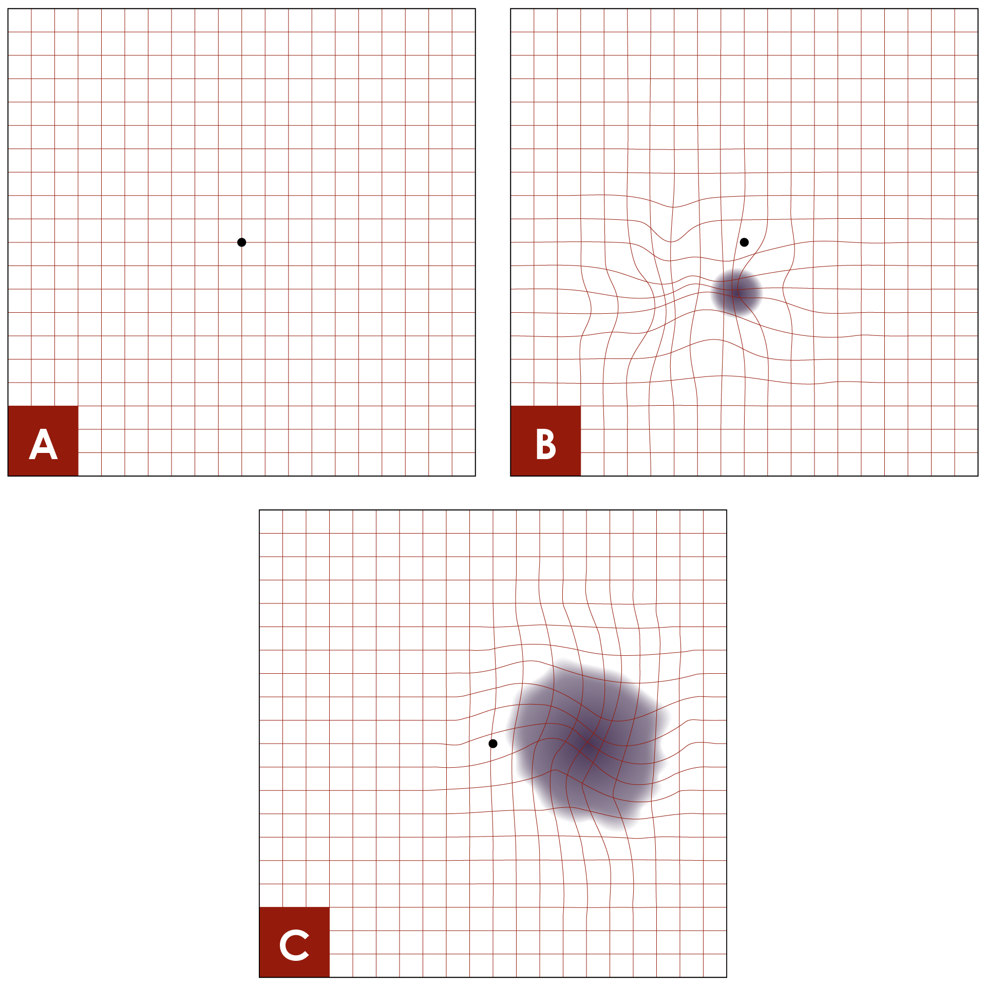Examples of the Amsler grid, when viewed by people with varying functional vision