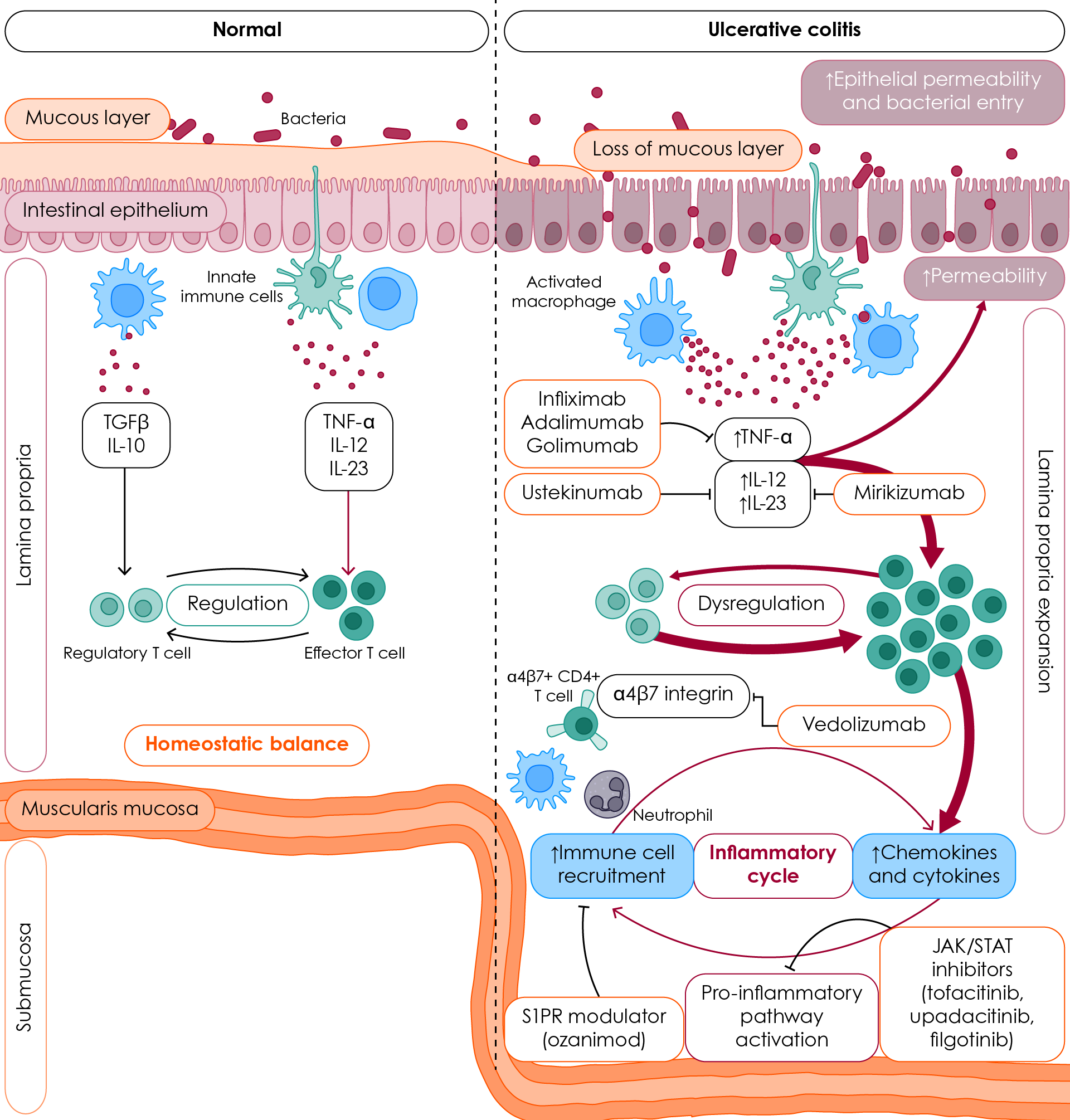 Figure 2. Mechanism of action for biologics and targeted small molecules in ulcerative colitis 18,22,25,26,28 (Adapted22). Image licensed under Creative Commons CC-BY 4.0. IL, interleukin; JAK/STAT, Janus kinase/signal transducers and activators of transcription; S1PR, sphingosine-1-phosphate receptor; TGFβ, transforming growth factor beta; TNF-α, tumour necrosis factor alpha.