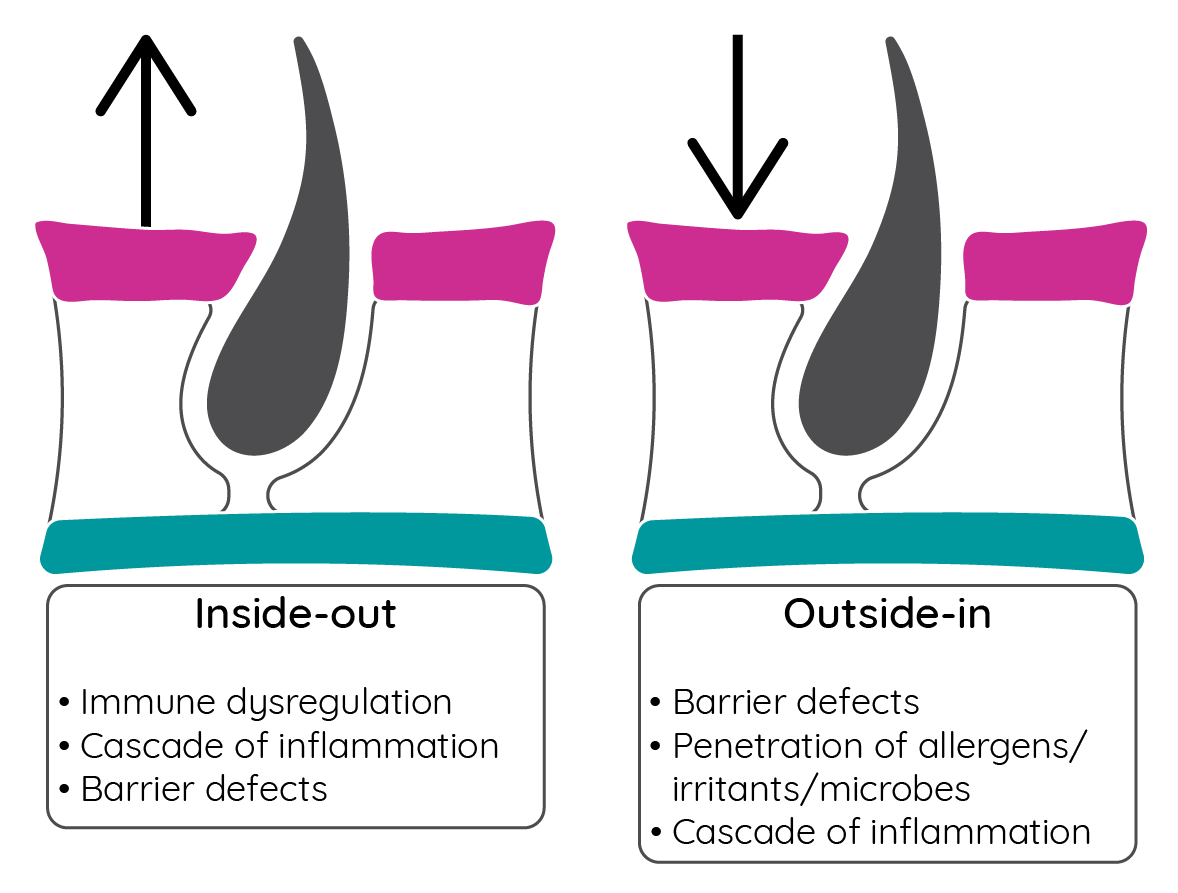 Theories of atopic dermatitis pathogenesis
