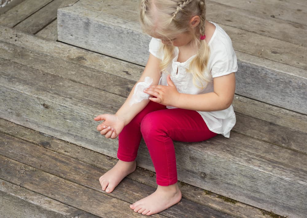 Child with psoriasis