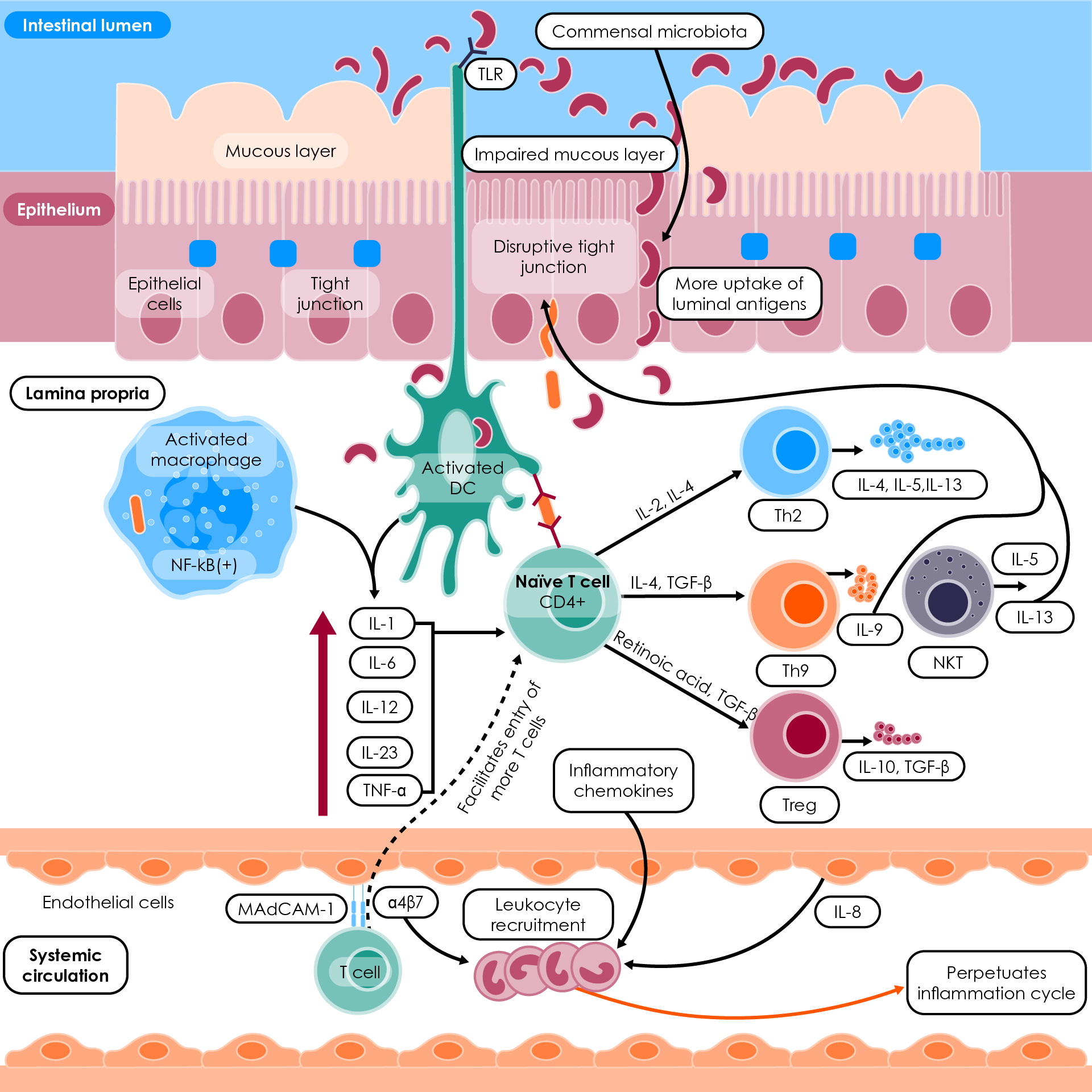 Pathophysiology of ulcerative colitis