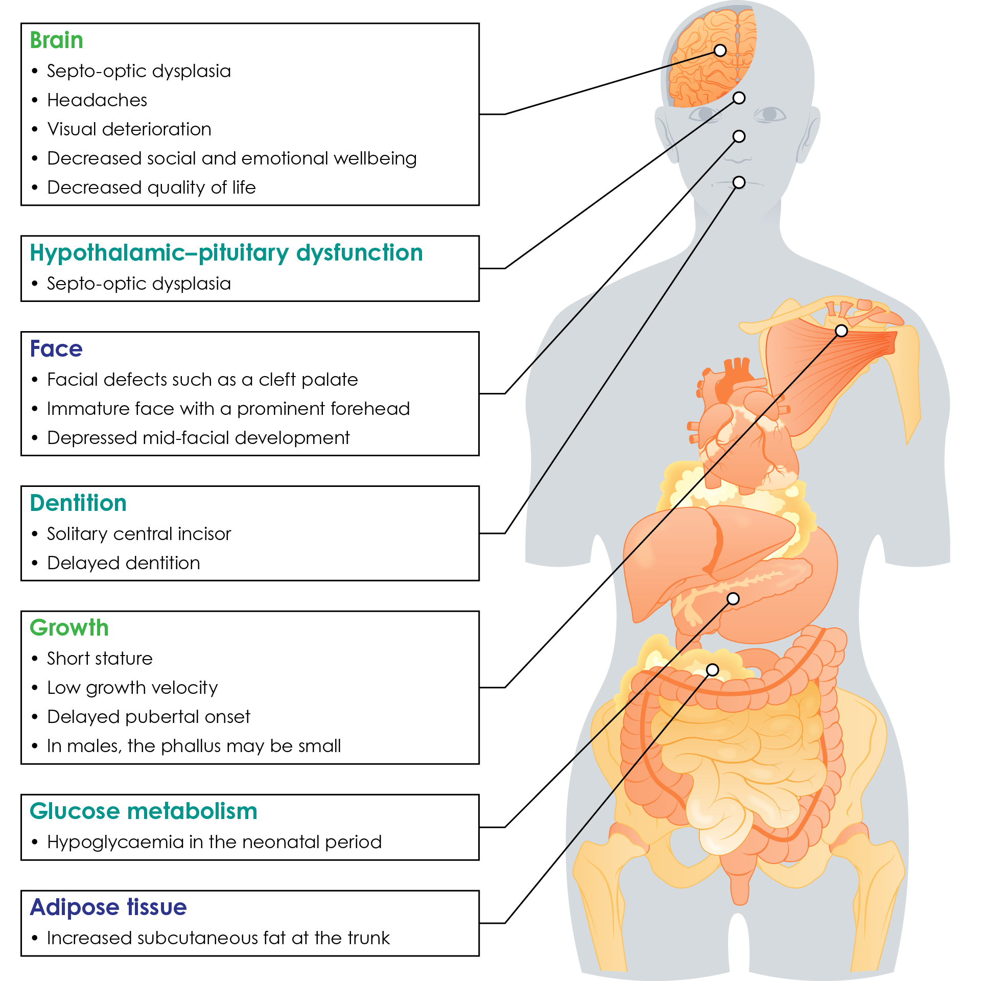 Clinical features of growth hormone deficiency in children