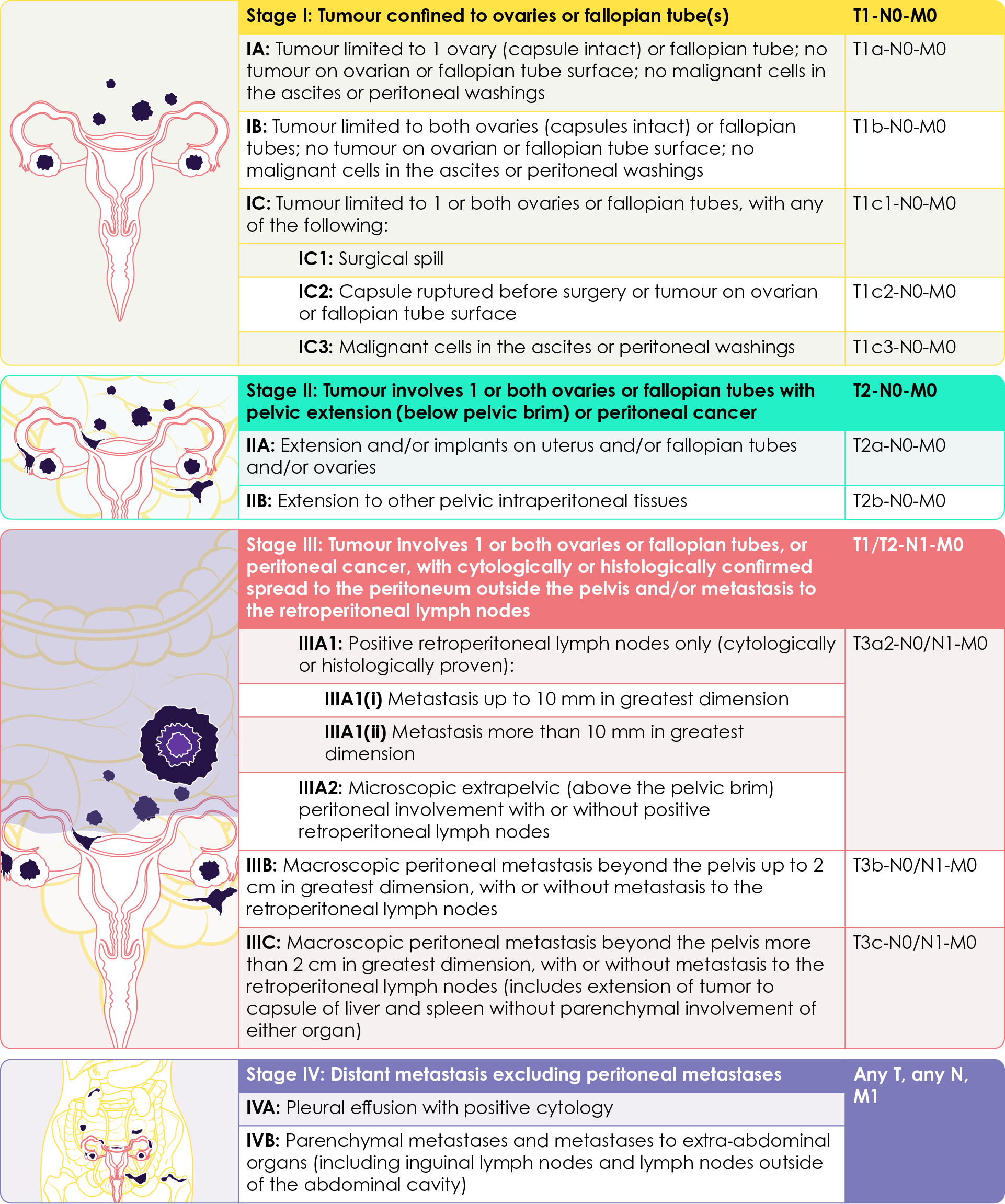 Classification of FIGO staging and its equivalent TNM classification for cancer of the ovary, fallopian tube and peritoneum