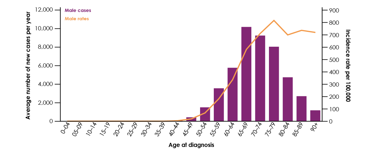 Figure 6. Average number of new cases per year and age-specific incidence rates per 100,000 males, UK. Adapted from CRUK Prostate Cancer Statistics
