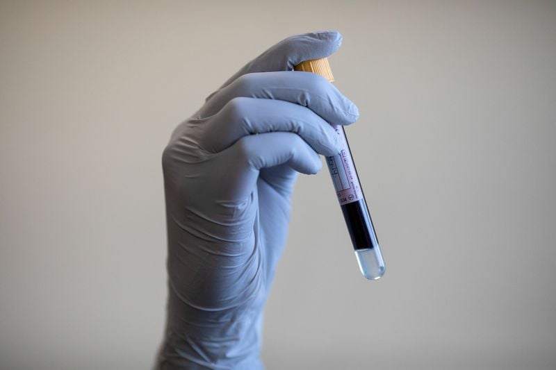 Health Rounds: Blood test improves detection of endometriosis-